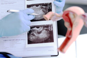 cursos diagnóstico de imagem na ginecologia